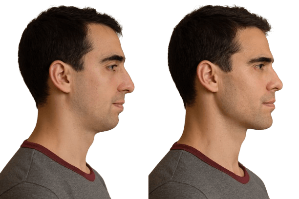 "Posture: How It Changes Your Appearance (and How to Fix It)"