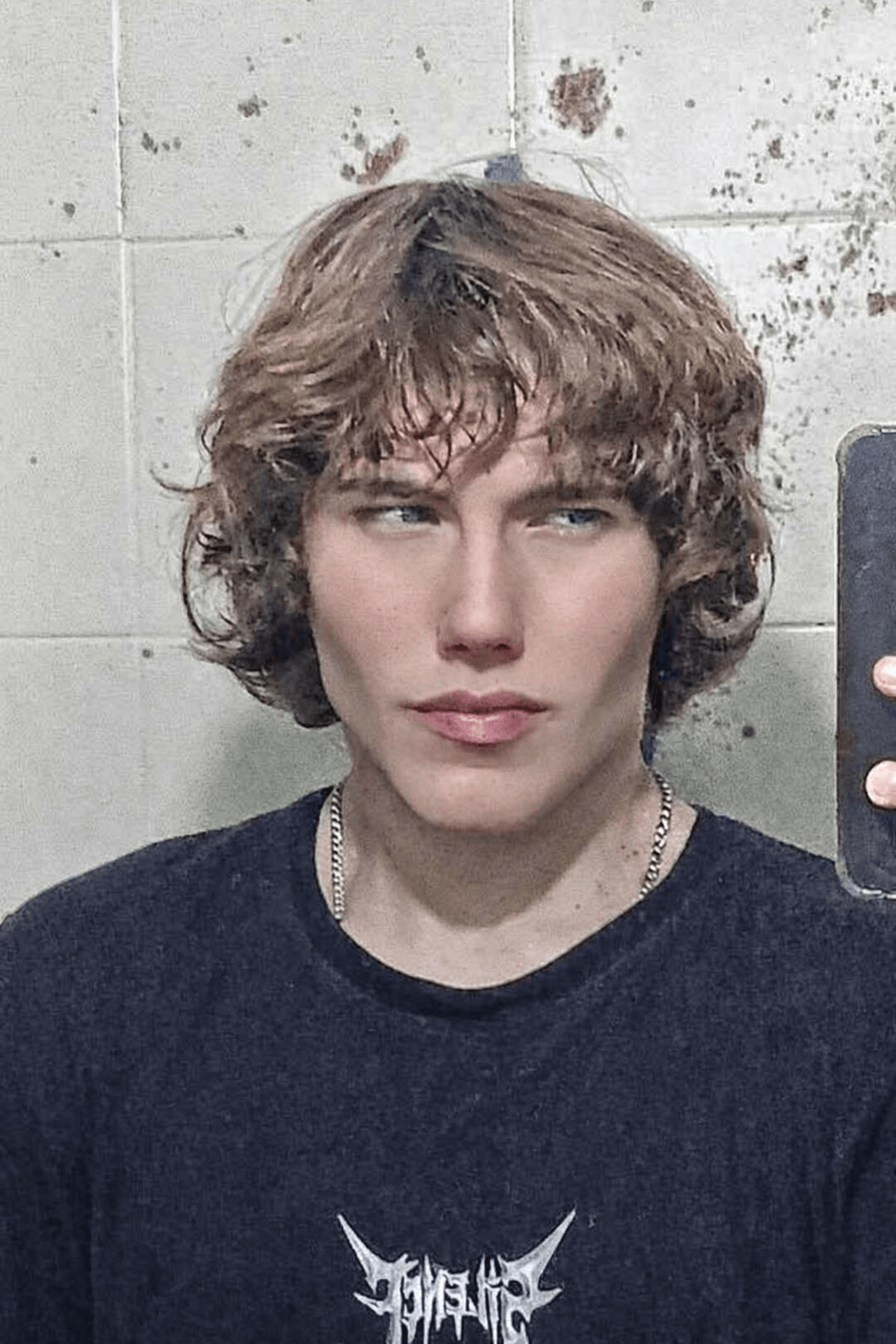 The Zygomatic Arch: How Cheekbone Width Shapes Your Face